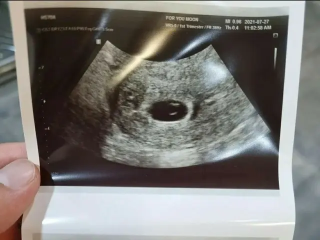 JIN will be ”Uncle” next year. My brother released a fetal photo. The fetal nameis ”butter” and it i