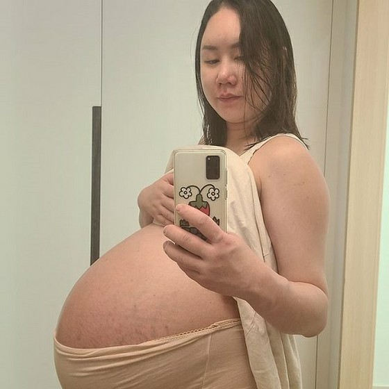 세 쌍둥이 임신 개그맨  황신영, 만삭에 "체중 104kg, 일어나기도 힘들어"