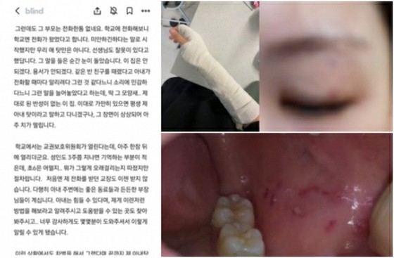 초등학교 6년 학생이 여성 교사를 '폭행'… 교사가 부모를 상대로 '소송' = 한국